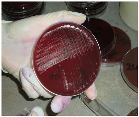 Figure 26 Helicobacter pylori Etude bactériologique des premières souches isolées à l’Hôpital Bologhine Ibn Ziri Figure 26 Helicobacter pylori Etude bactériologique des premières souches isolées à l’Hôpital Bologhine Ibn Ziri
