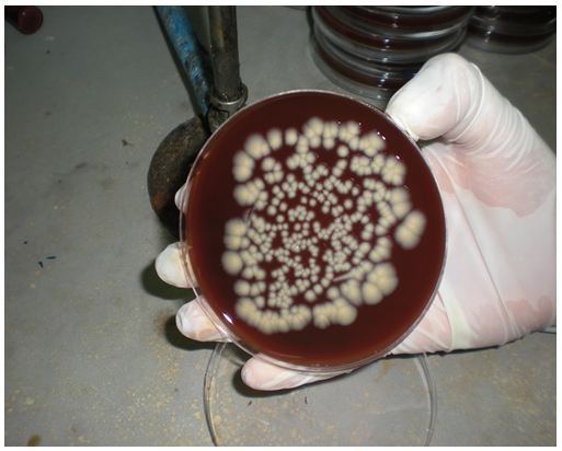 Figure 27 Helicobacter pylori Etude bactériologique des premières souches isolées à l’Hôpital Bologhine Ibn Ziri Figure 27 Helicobacter pylori Etude bactériologique des premières souches isolées à l’Hôpital Bologhine Ibn Ziri