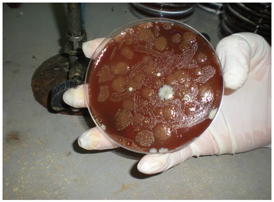 Figure 28 Helicobacter pylori Etude bactériologique des premières souches isolées à l’Hôpital Bologhine Ibn Ziri Figure 28 Helicobacter pylori Etude bactériologique des premières souches isolées à l’Hôpital Bologhine Ibn Ziri