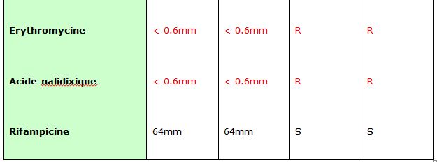 Tableau 13' Helicobacter pylori Etude bactériologique des premières souches isolées à l’Hôpital Bologhine Ibn Ziri Tableau 13' Helicobacter pylori Etude bactériologique des premières souches isolées à l’Hôpital Bologhine Ibn Ziri