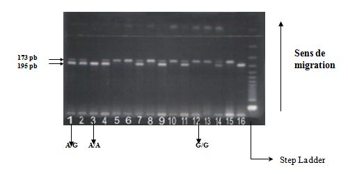 Polymorphisme A G en position (+49) de l’exon 1 du gène du CTLA-4'