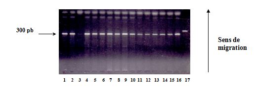 Polymorphisme du gène de l’Apo 1 Fas Vérification de l’amplification sur gel d’agarose à 2