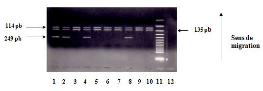 Polymorphisme à la position +3954 du gène de l’IL1. Révélation des produits de digestion sur gel d’agarose à 4