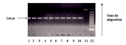 Polymorphisme à la position +3954 du gène de l’IL1Vérification de l’amplification sur gel d’agarose à 2