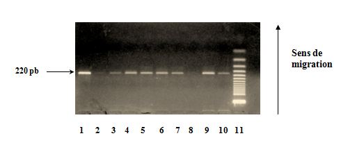 Polymorphisme à la position (-889)  du gène de l’IL1-α Vérification de l’amplification sur gel d’agarose à 2