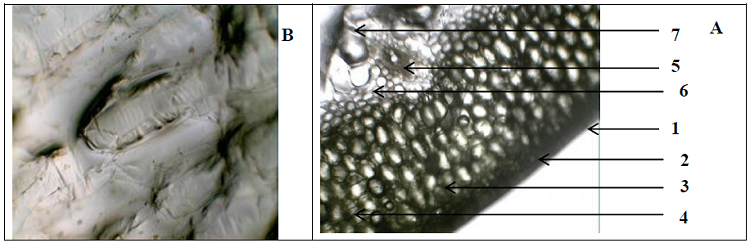 Anatomie de la feuille et du gel Anatomie de la feuille et du gel